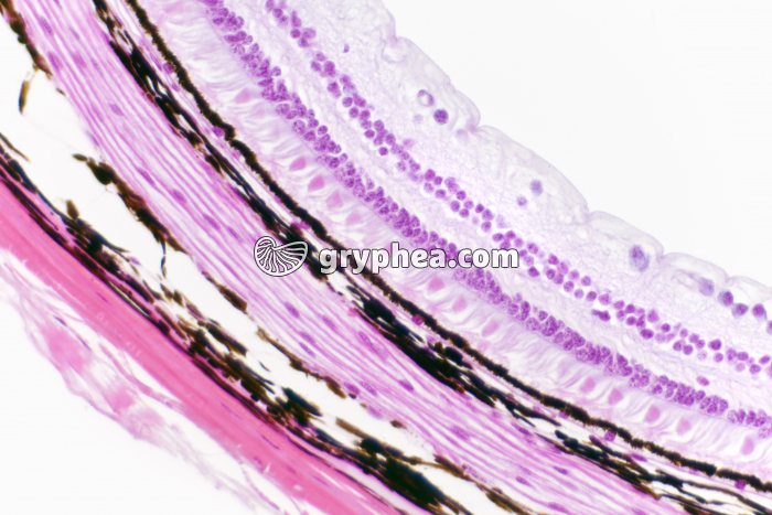 Rétine périphérique x100 - gryphea.org